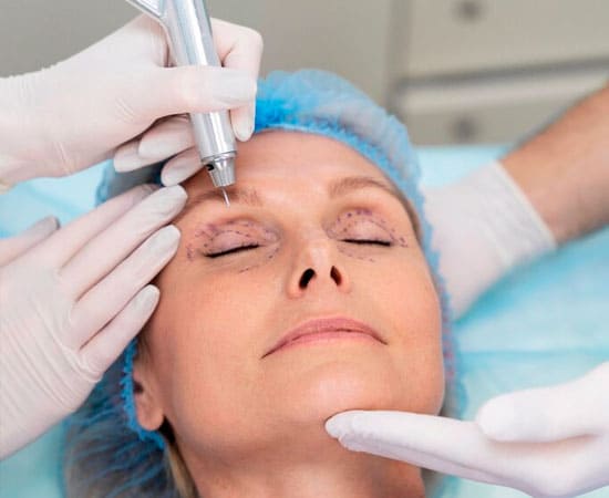 Blefaroplastia - cirurgia de pálpebras