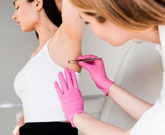 Exérese dermatológica