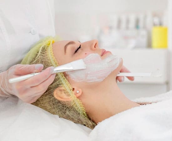 Peeling químico